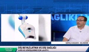 DİŞ BEYAZLATMA